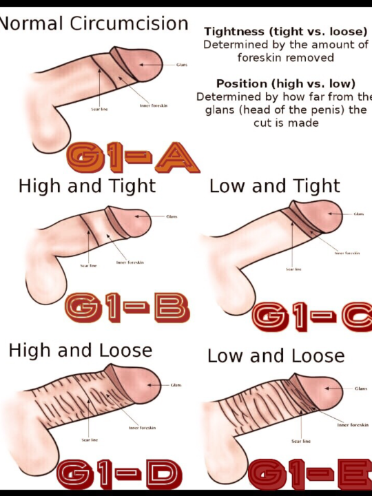 Circumcision Declaration